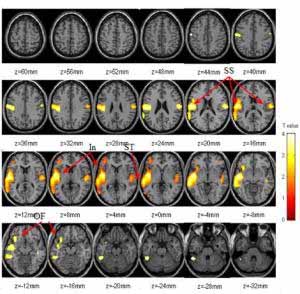 differences in brain metabolism